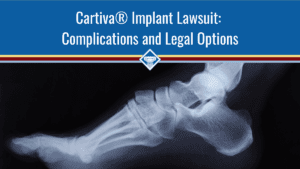 Image of a foot x-ray against a black background. The title of the article, "Cartiva® Implant Lawsuit: Complications and Legal Options" is placed at the top of the image inside of a blue bar that stretches across the image.