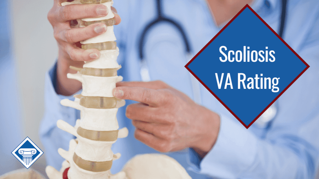 A doctor pointing to a spot on the spine of a fake human skeleton model. Over the image is a diamond reading the article title: Scoliosis VA rating.