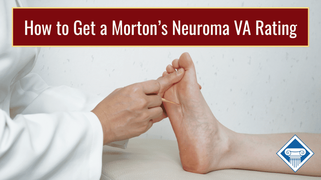 Photo of a doctor wearing a white coat touching a person's foot, which is propped up on a table. Article title is across the top: How to Get a Morton's Neuroma VA Rating